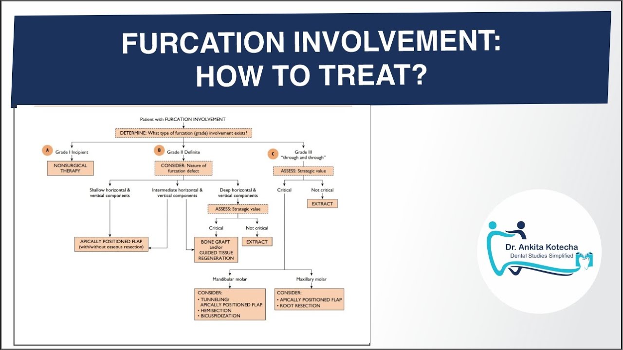 DECISION MAKING: FURCATION INVOLVEMENT: HOW TO TREAT?/ DR. ANKITA KOTECHA/ DENTAL STUDIES SIMPLIFIED