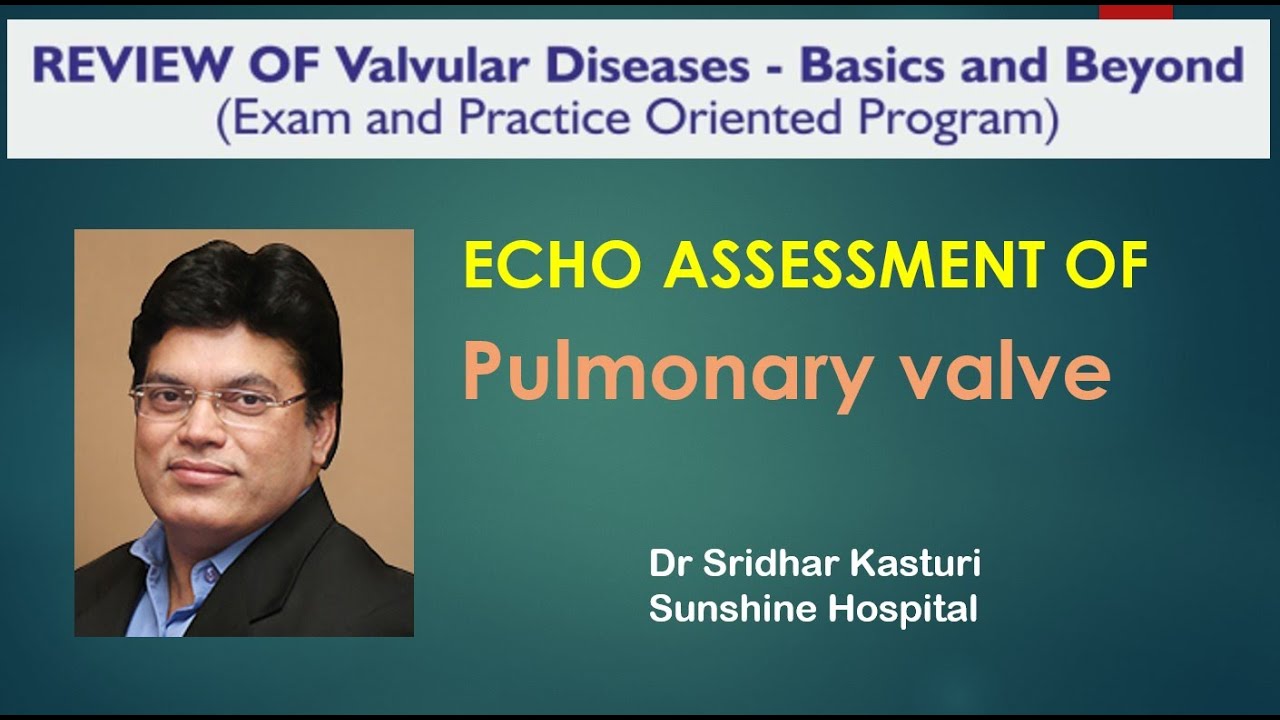 Echo assessment of Pulmonary Valve Dr Shaik Swalehin BUX