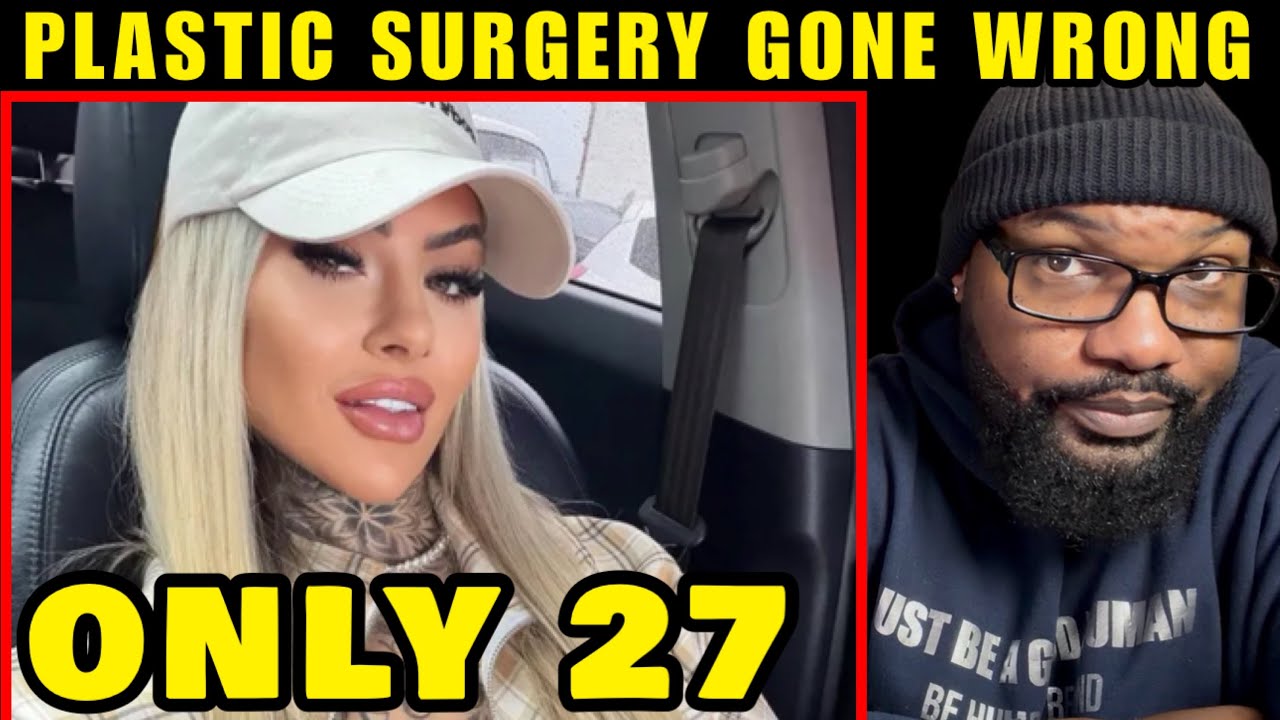  Brazilian Influencer Bianca Dias Dies At Age 27 After Plastic Surgery 