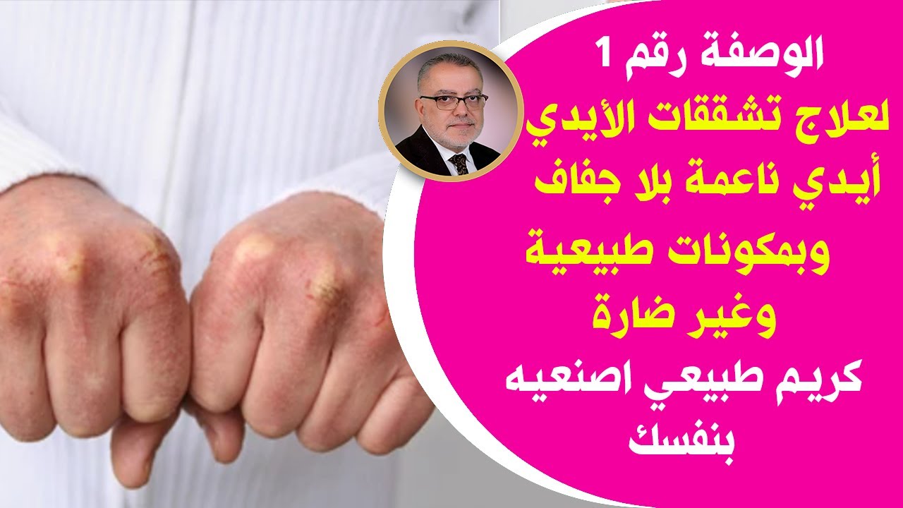 وصفة طبيعية مضمونة لعلاج جفاف اليدين والتشققات أيدي في غاية النعومة بدون جفاف أو تجاعيد وبدون عناء