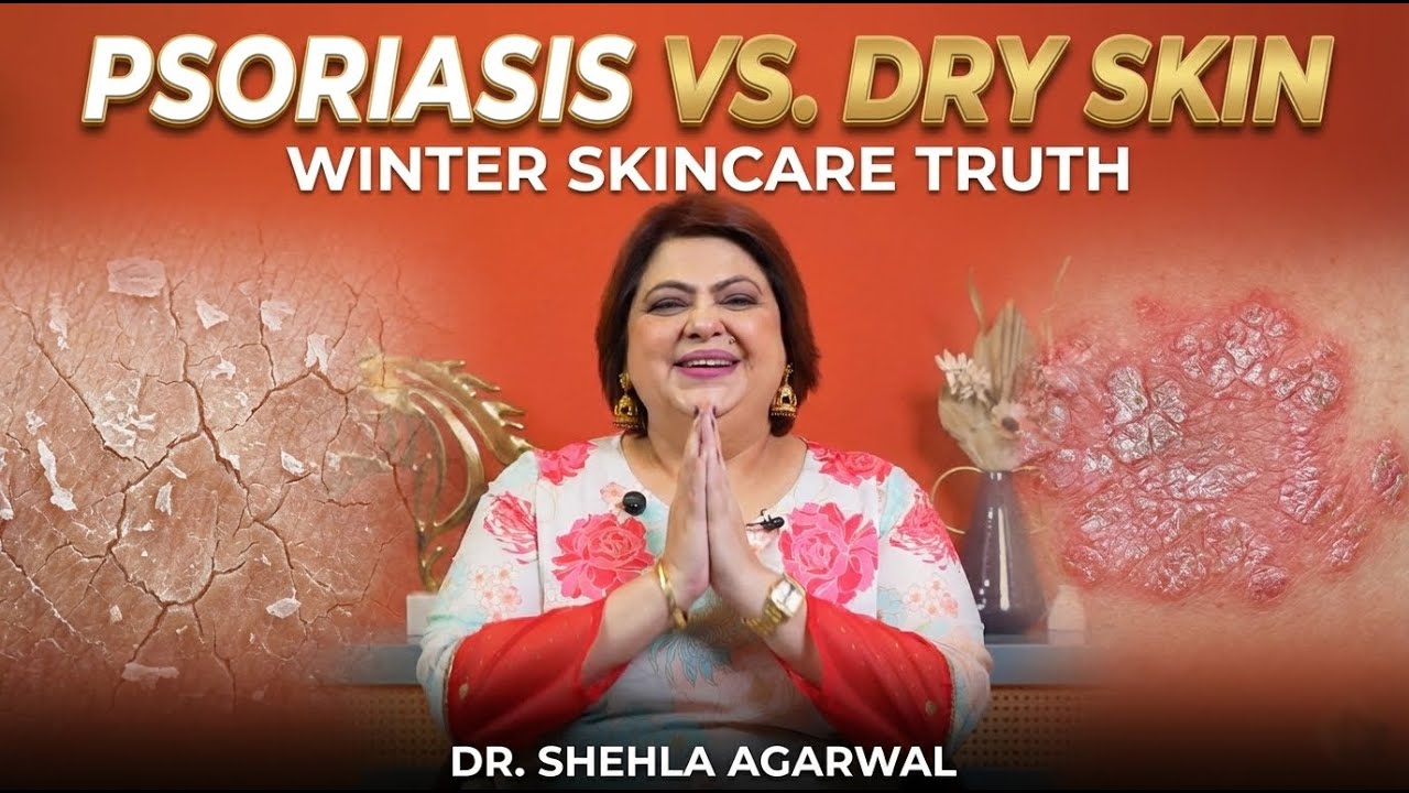 The Ultimate Winter Skincare Guide: Psoriasis or Just Dry Skin?