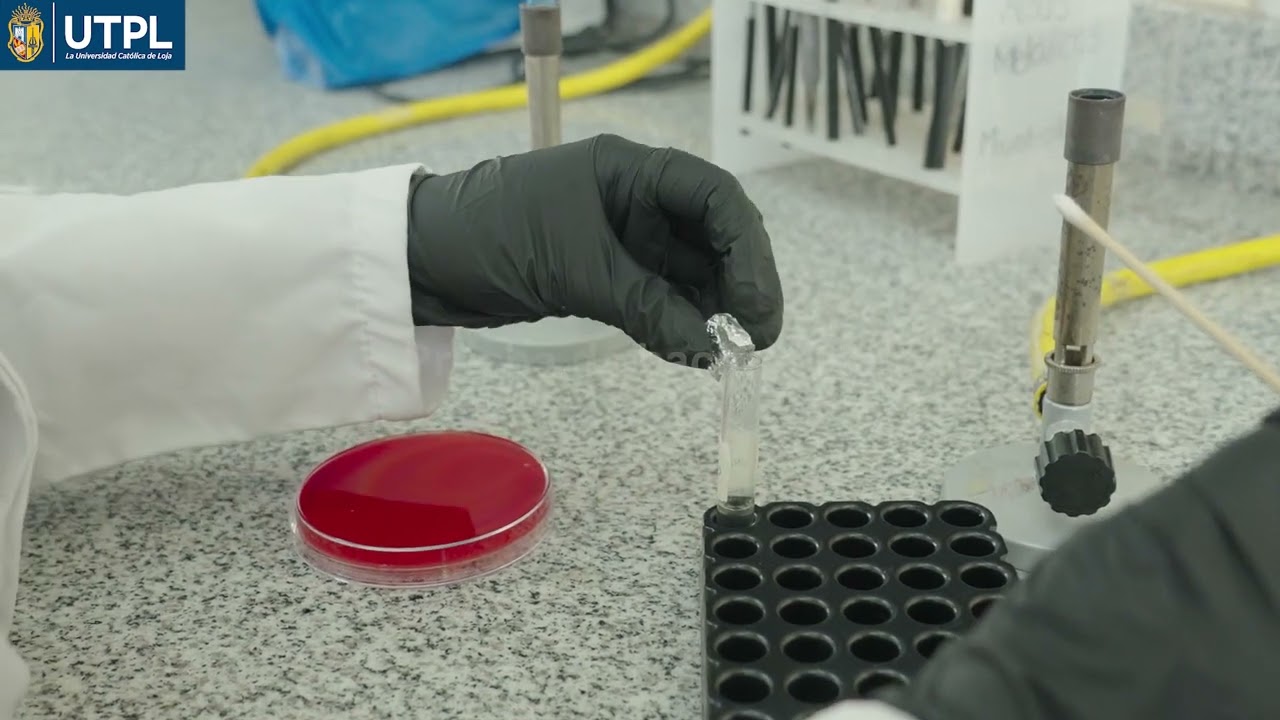 Identificación de Streptococcus: cultivo de secreción faríngea