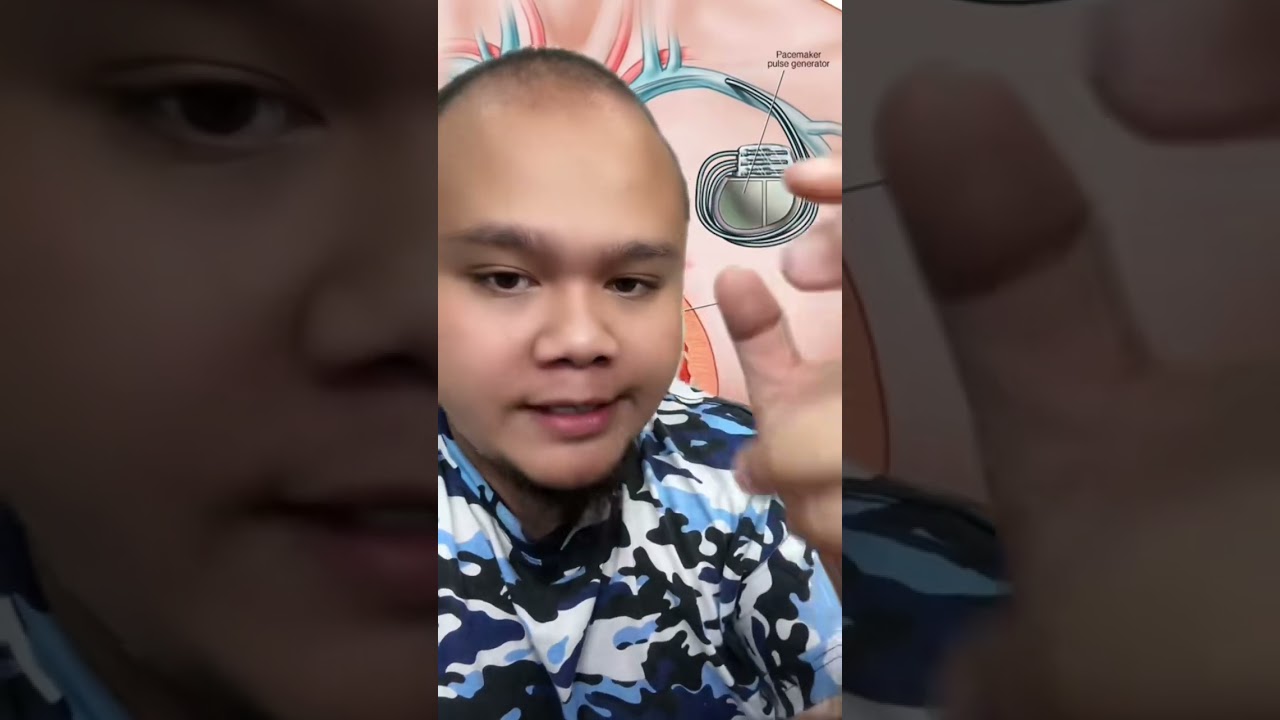 TUKAR BATERI JANTUNG RM38 RIBU..?
