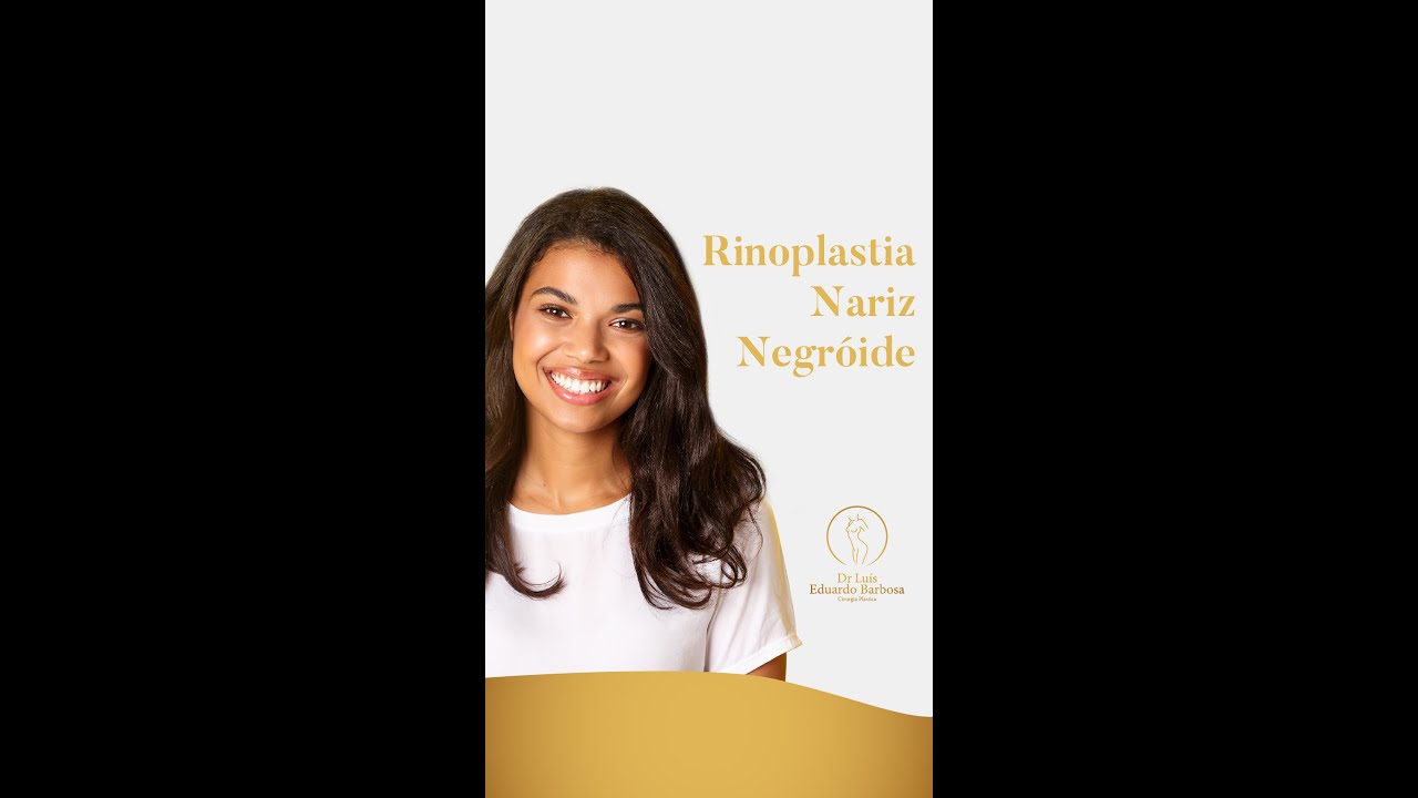 Rinoplastia em Nariz Negr&oacute;ide