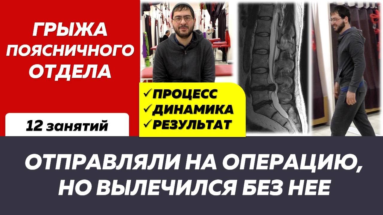 История лечения грыжи без операции и лекарств. Межпозвонковая грыжа лечится без операции
