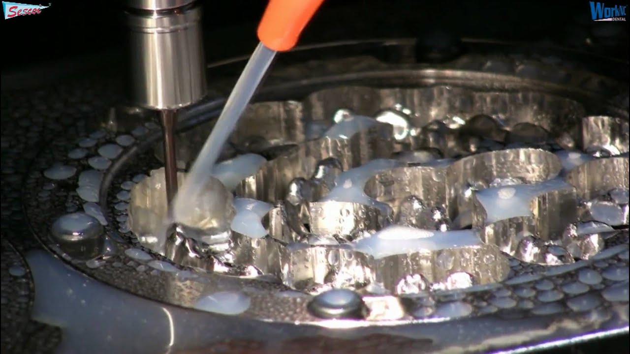 CNC dental CAD/CAM machining with Wissner and WorkNC Dental