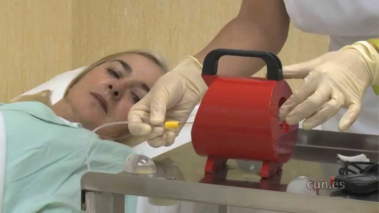 Radiofármacos para la detección precoz de enfermedades