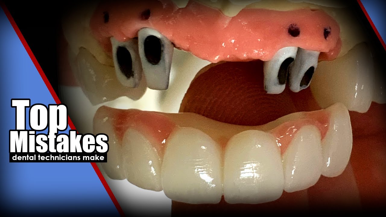 Top Mistakes Dental Technicians Make Episode 1