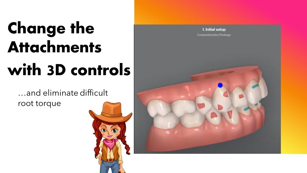 Invisalign ClinCheck - Changing attachments with 3D controls