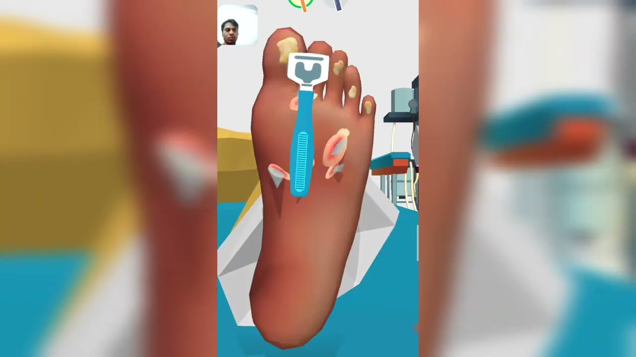 ASMR Satisfying Foot Treatment//  Remove Glass pieces From Foot Animation
