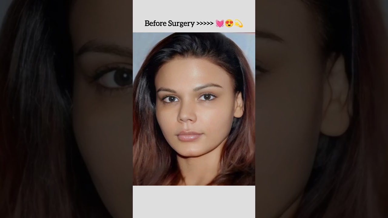 Rakhi Sawant Before Surgery 💓😍💫 #rakhisawant #status #trending #viral