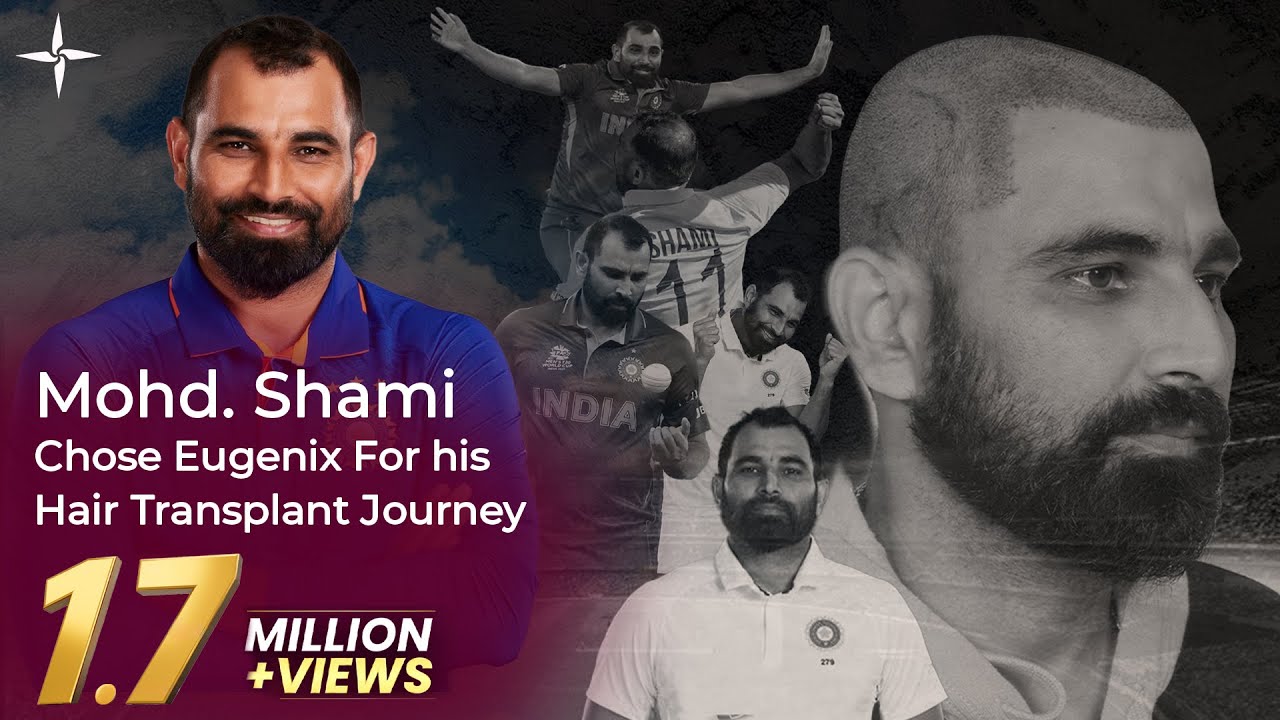 Cricketer Hair Transplants: Mohd. Shami's Hair Transformation Journey with Eugenix