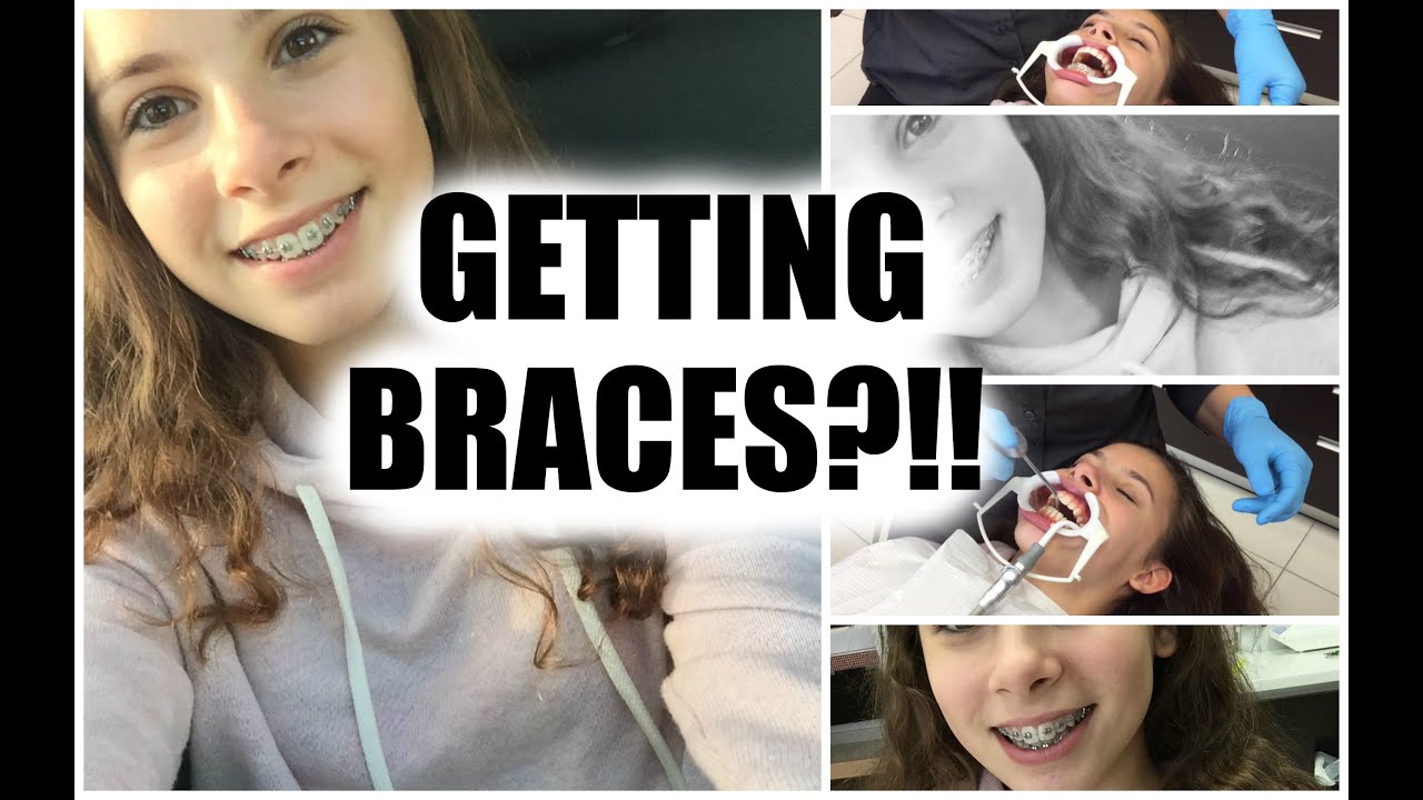 GETTING BRACES?!
