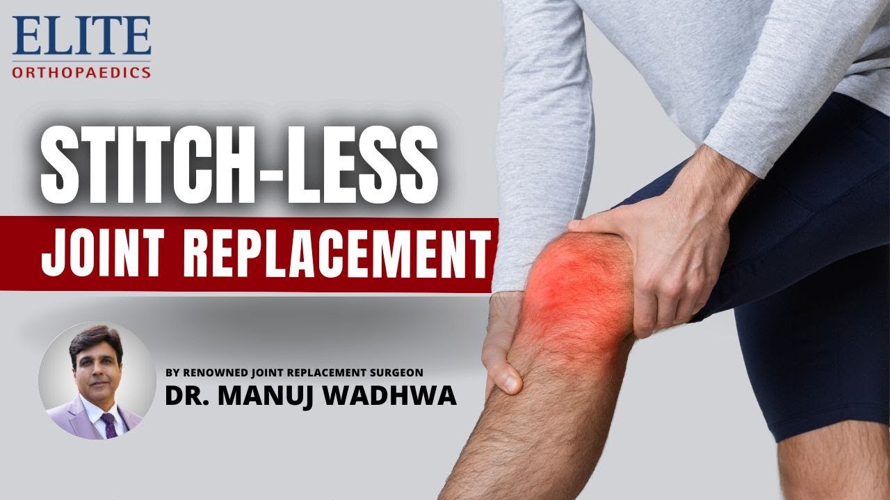The Evolution of Stitch-less Joint Replacement: Expert insides by Renowned Surgeon Dr. Manuj Wadhwa