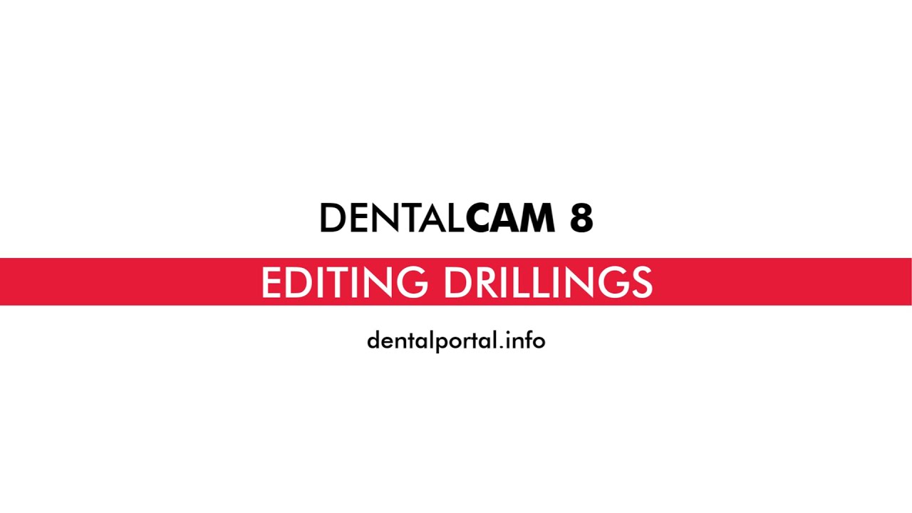 DentalCAM 8 – Editing drillings