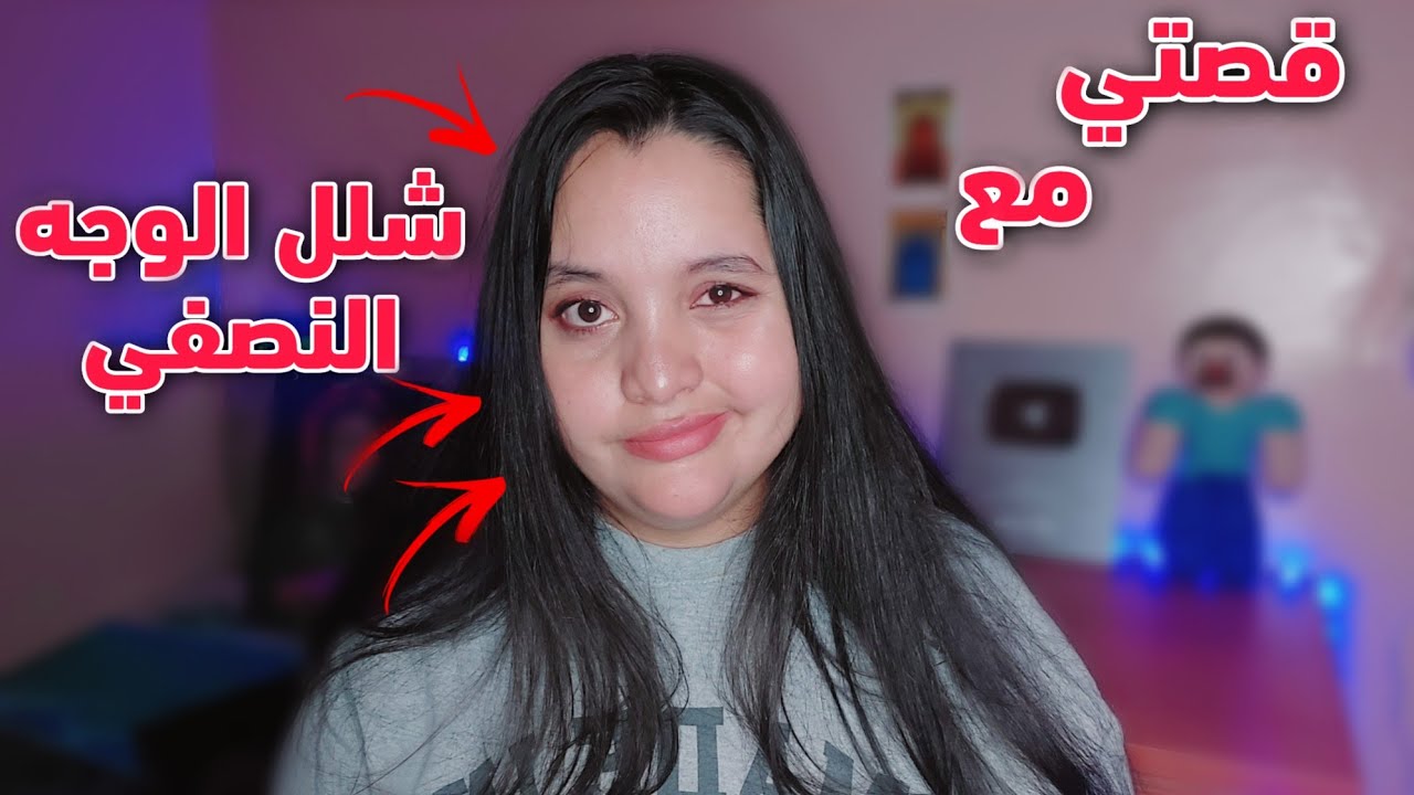 قصتي مع شلل الوجه النصفي متلازمة رامزي هانت !!؟