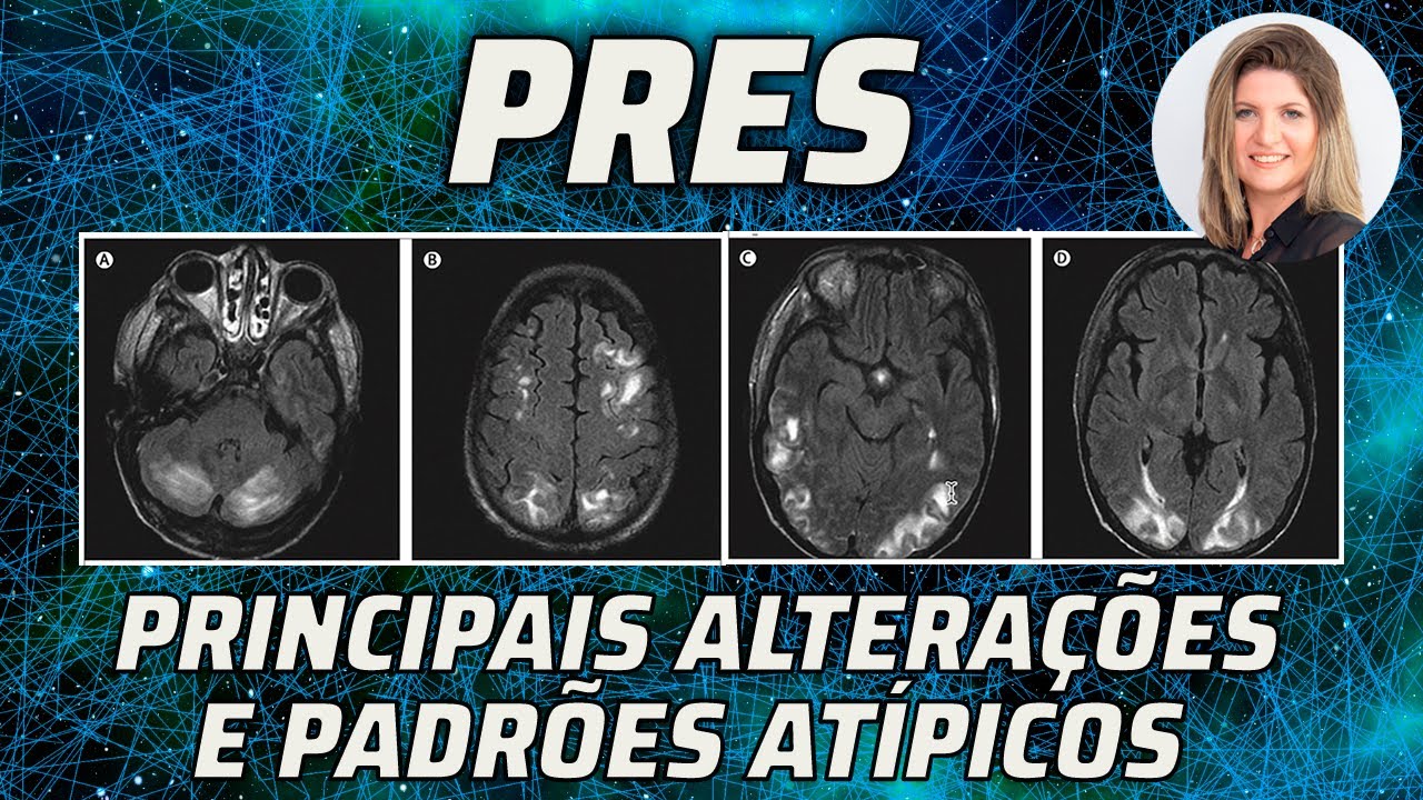 PRES: PRINCIPAIS ALTERAÇÕES DE IMAGEM E PADRÕES ATÍPICOS