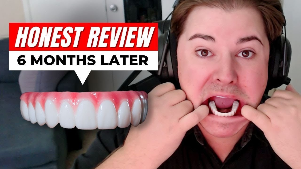 I Wish I Knew THESE Struggles Before Getting Dental Implants…