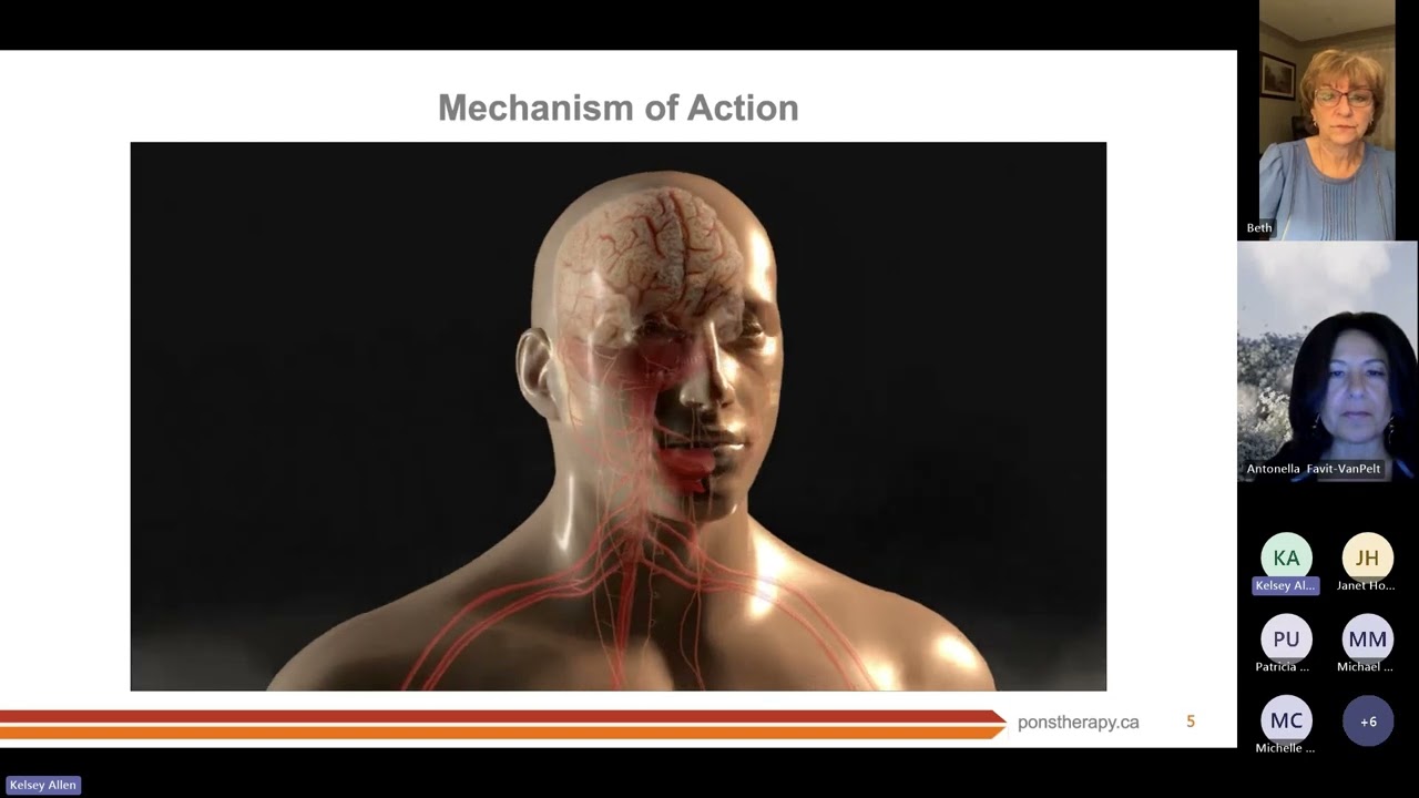 PoNS Patient Webinar (Canada) Jan 2025