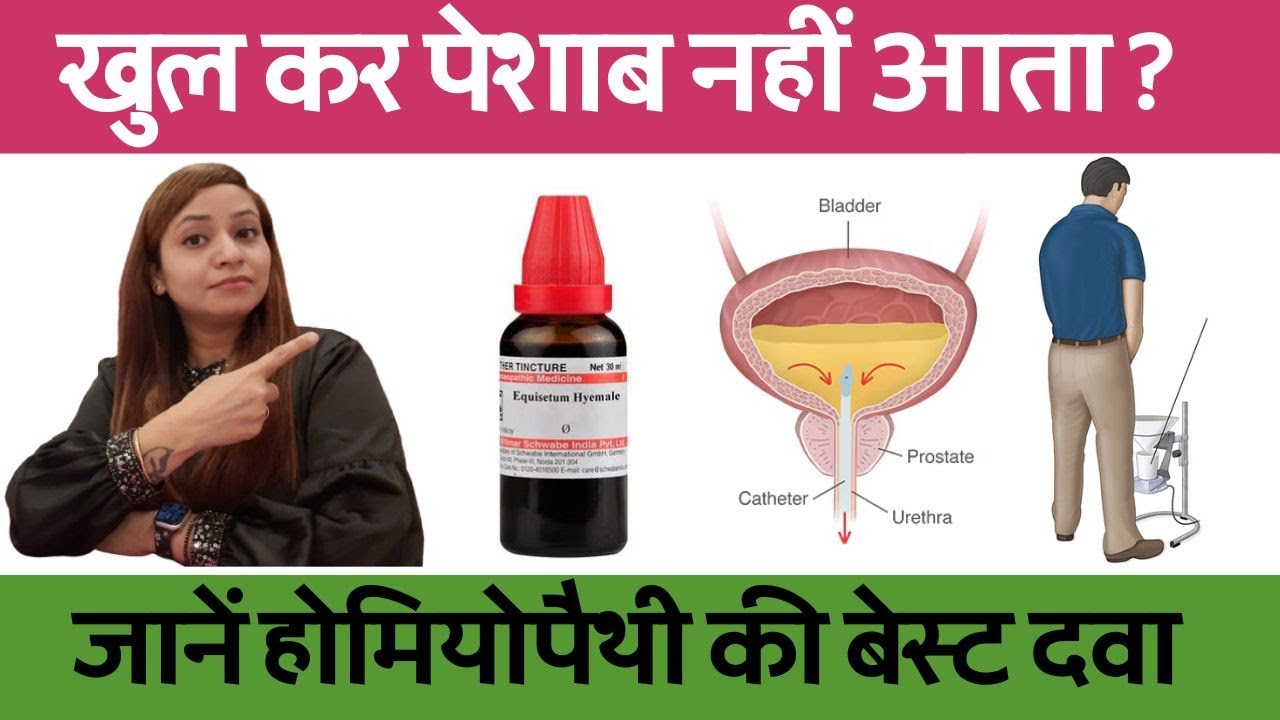 रुक रुक कर पेशाब आना | Slow Urine Flow Male | Urine flow treatment by homeopathy