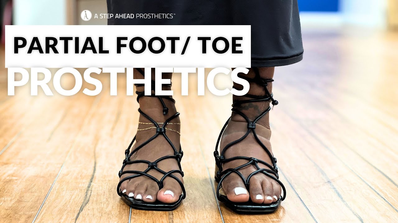 Daniel's New Realistic Silicone Partial Foot Prosthesis: Transmetatarsal