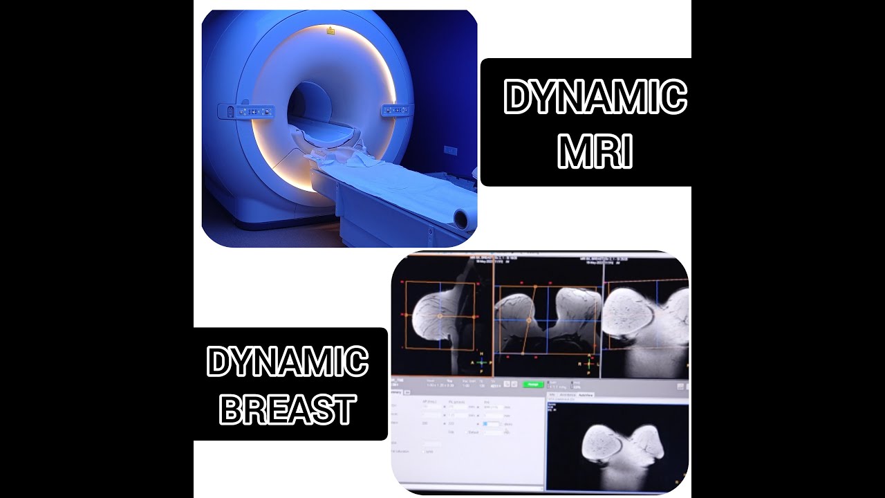 MRI DYNAMIC BREAST II DYNAMIC STUDY.                       #philips #mri #dynamic