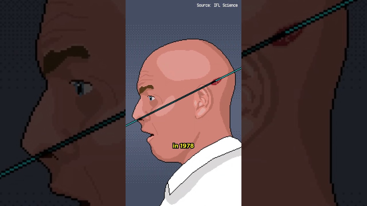 Man Sticks Head in Particle Accelerator 😨