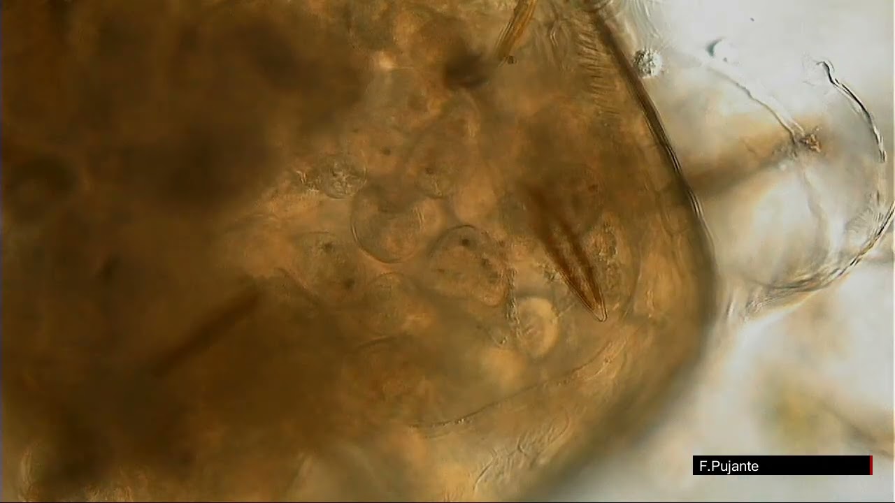TETRAHYMENA CILIADO