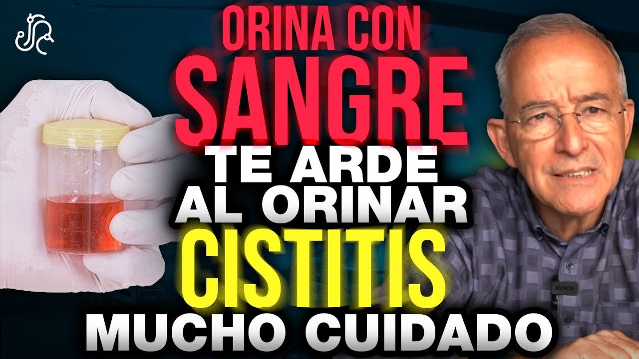 SI TIENES ORINA CON SANGRE Y Te Arde Tienes Que Ver Esto - Oswaldo Restrepo RSC