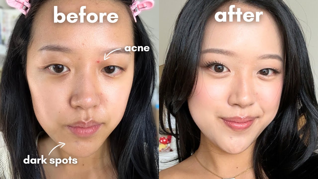 easy makeup routine for ACNE-PRONE & SENSITIVE SKIN
