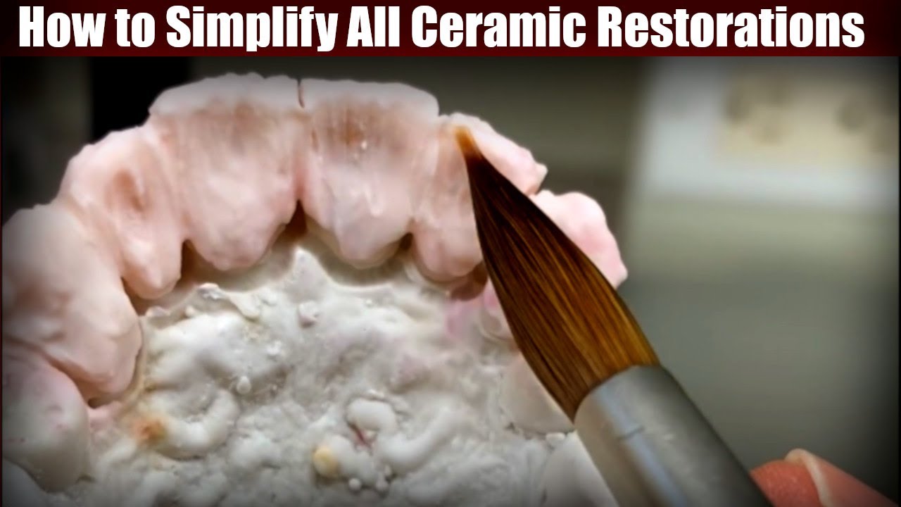 How to Simplify All Ceramic Restorations | 모든 세라믹 복원을 단순화하는 방법