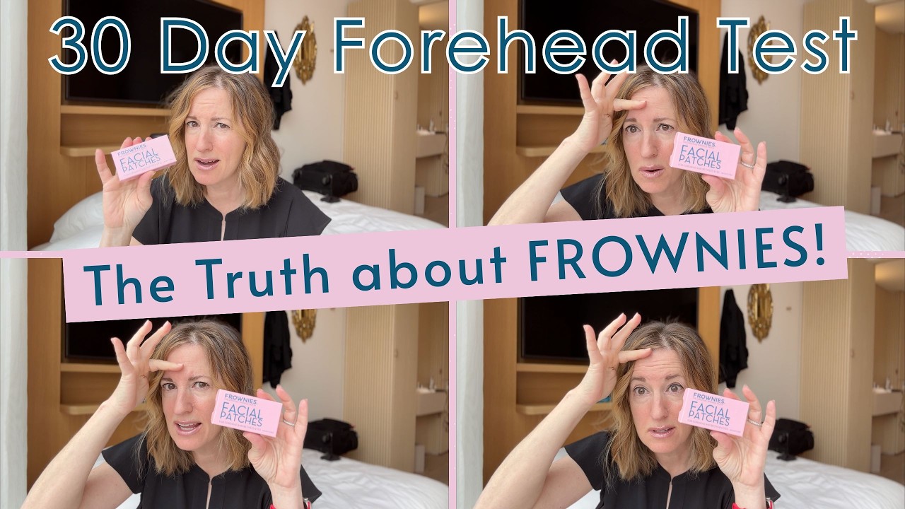 The TRUTH about Frownies - 30 Day Test and Review