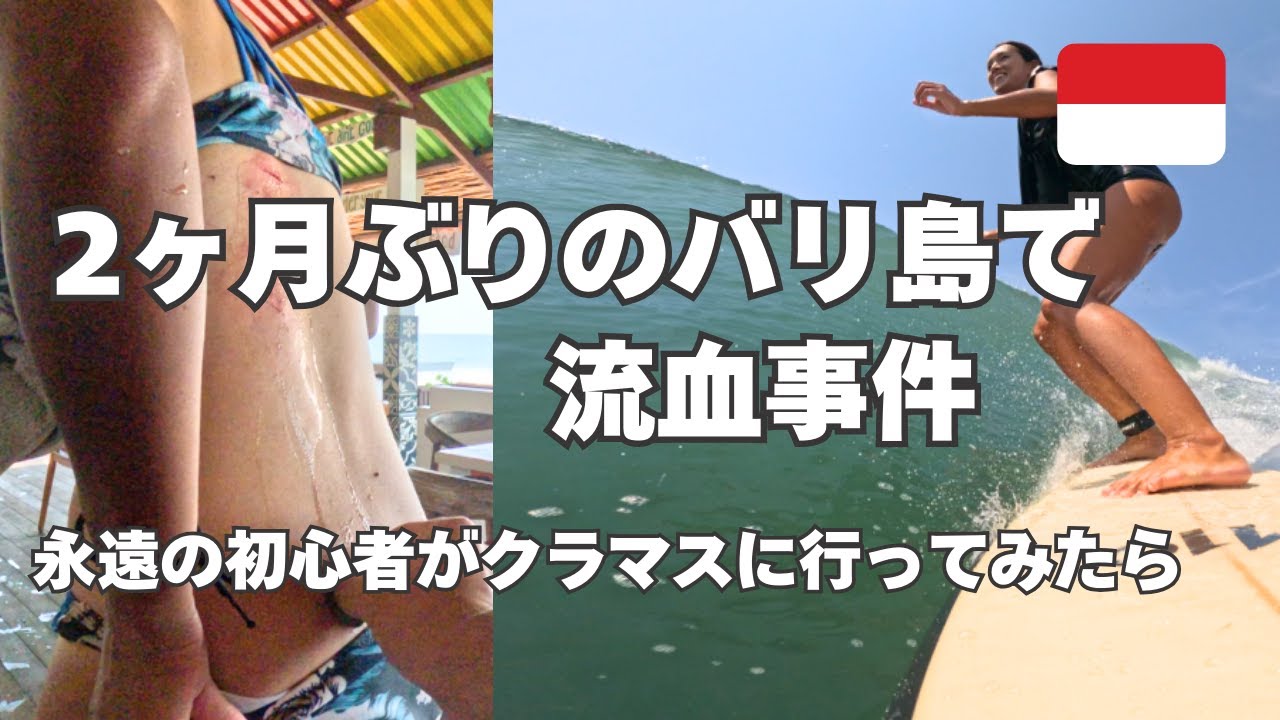 【バリ島】クラマスにサーフィンに行ったら流血したアラフォー女