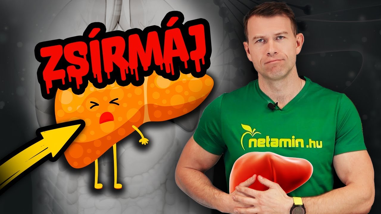 Zsírmáj: a leggyakoribb májbetegség, amely már a fiatalokat is érinti. Mit tehetsz ellene?