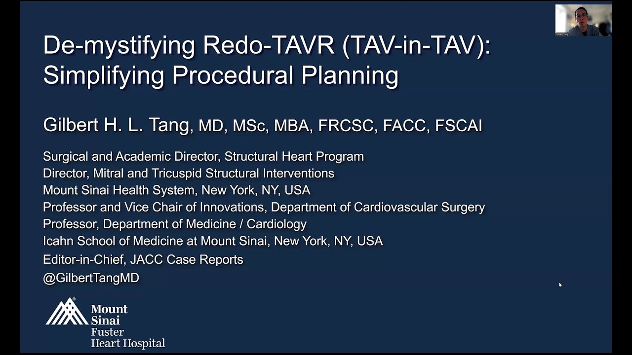 Lecture:  Redo-TAVR (TAV-in-TAV) Workup simplified
