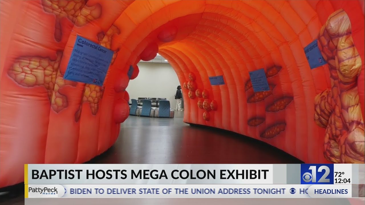 Baptist hosts Mega Colon exhibit