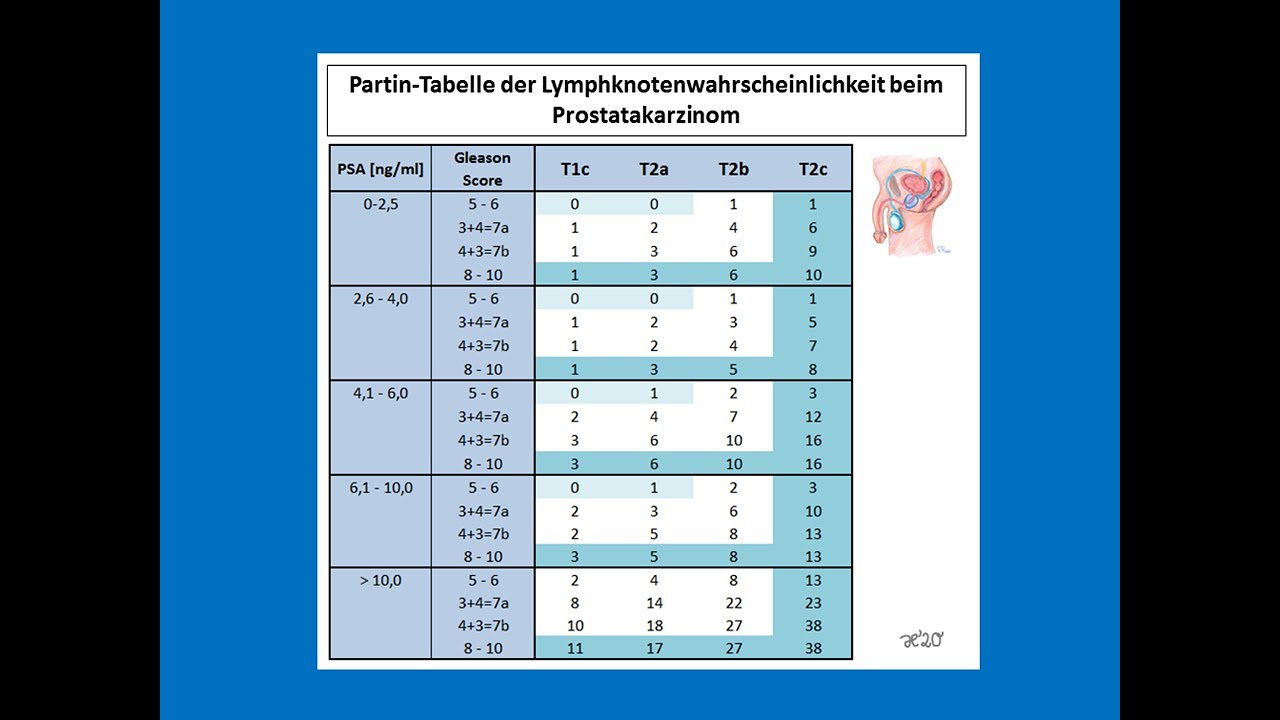 Partintabelle der Lymphknoten beim Prostatakarzinom | Strahlentherapie Prof. Hilke Vorwerk