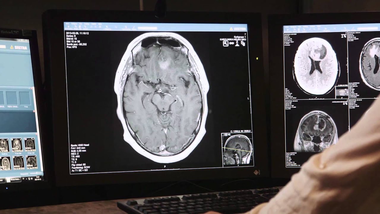 The Human Brain Project SP5: Neuroinformatics