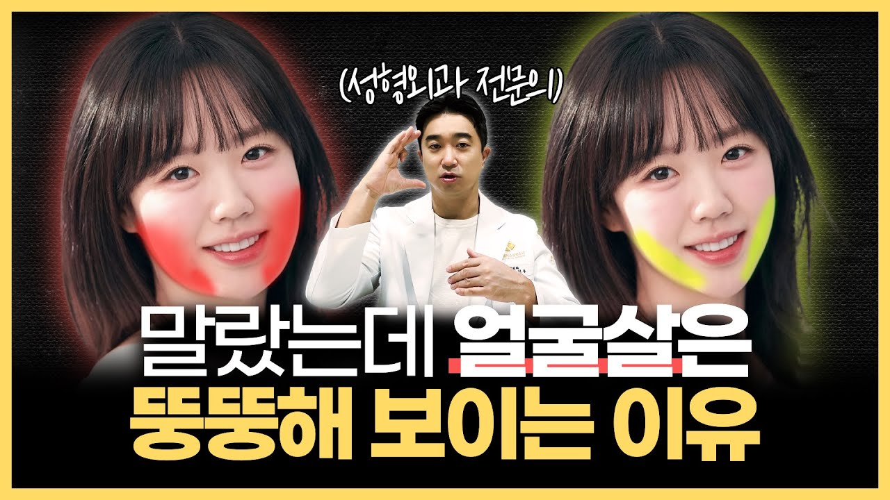 강남 성형외과 원장이 알려주는 “말랐는데 얼굴살은 뚱뚱해 보이는 이유” | 얼굴살, 얼굴형, 얼굴크기