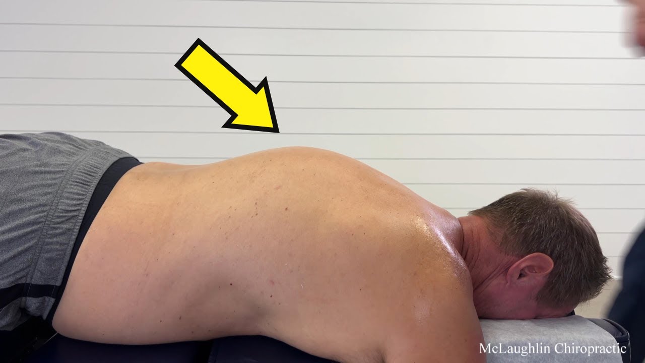 Tall People PROBLEMS! Hyperkyphosis LOCKS His Back 😳 STRETCHING & CRACKS Help A Rounded BACK