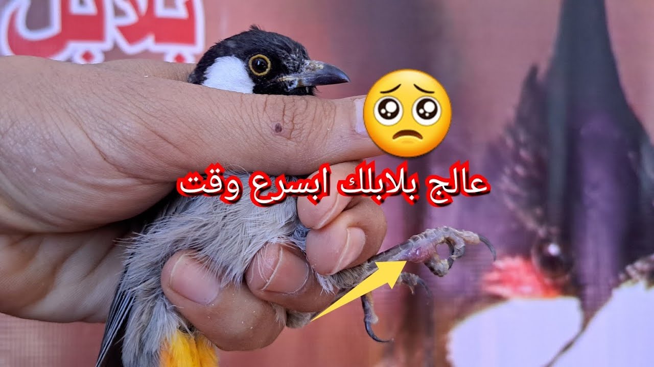 علاج فطريات البلابل ابسرع وقت 🤏🧑‍⚕️
