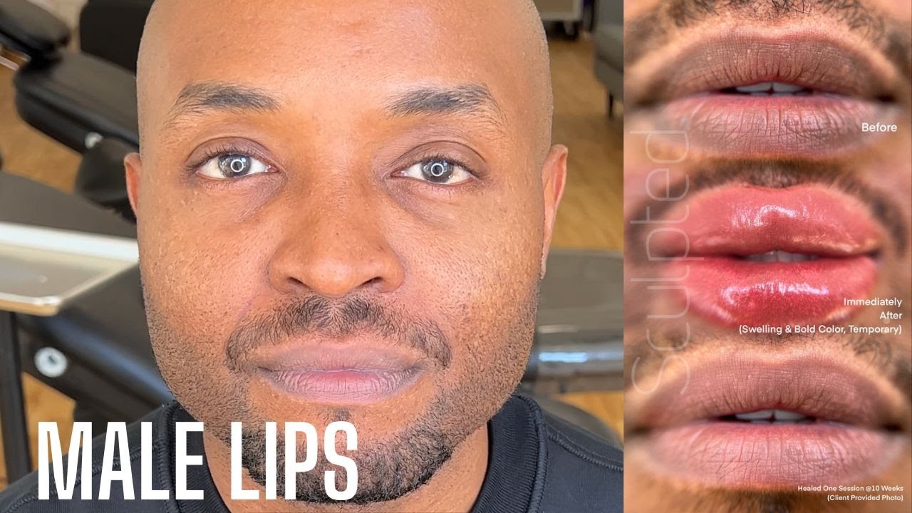 Male Lip Neutralization