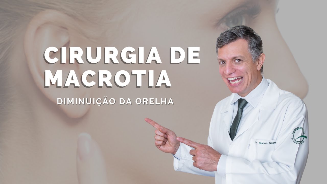 COMO É FEITA A CIRURGIA DE MACROTIA - DIMINUIÇÃO DA ORELHA