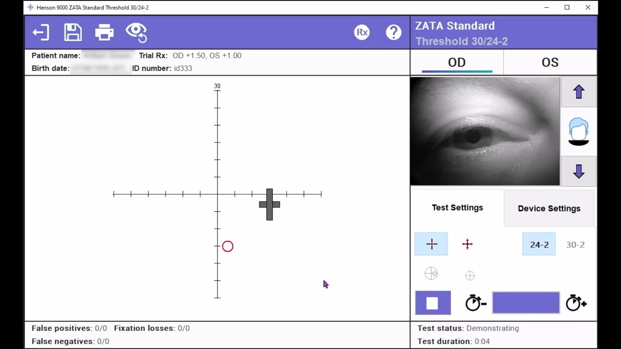 Visual field threshold testing using Henson 9000&rsquo;s ZATA Standard 24-2 on Topcon&rsquo;s Henson 9000