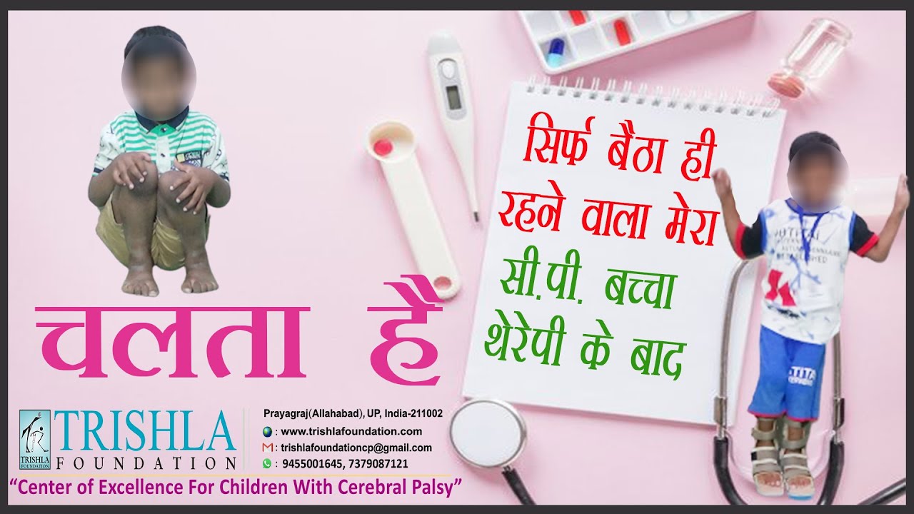 CP Success Story: Unbelievable Outcome of Cerebral Palsy Treatment | Trishla Foundation [Hindi]