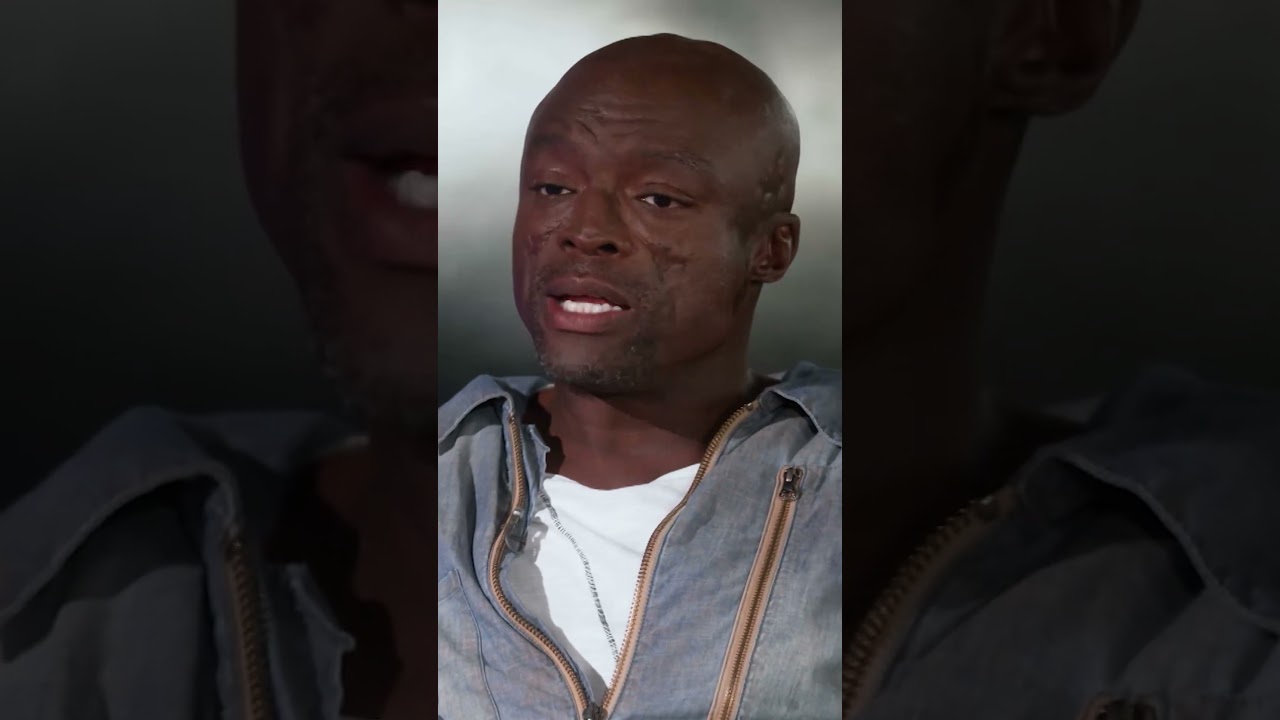 How Seal's scars affected his career #lupus #scars #selflove