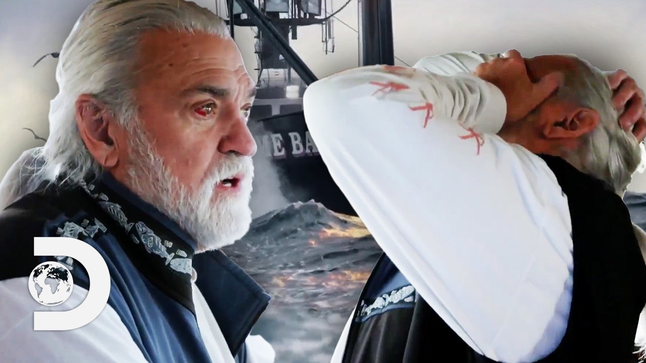 Most BRUTAL Injuries On The Bering Sea | Dangerous Moments | Deadliest Catch