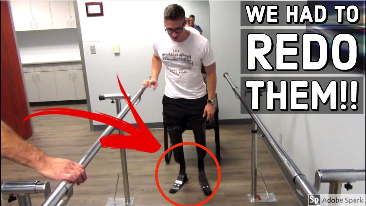 Amputee's First Steps on NEW Prosthetic Legs - Part 4