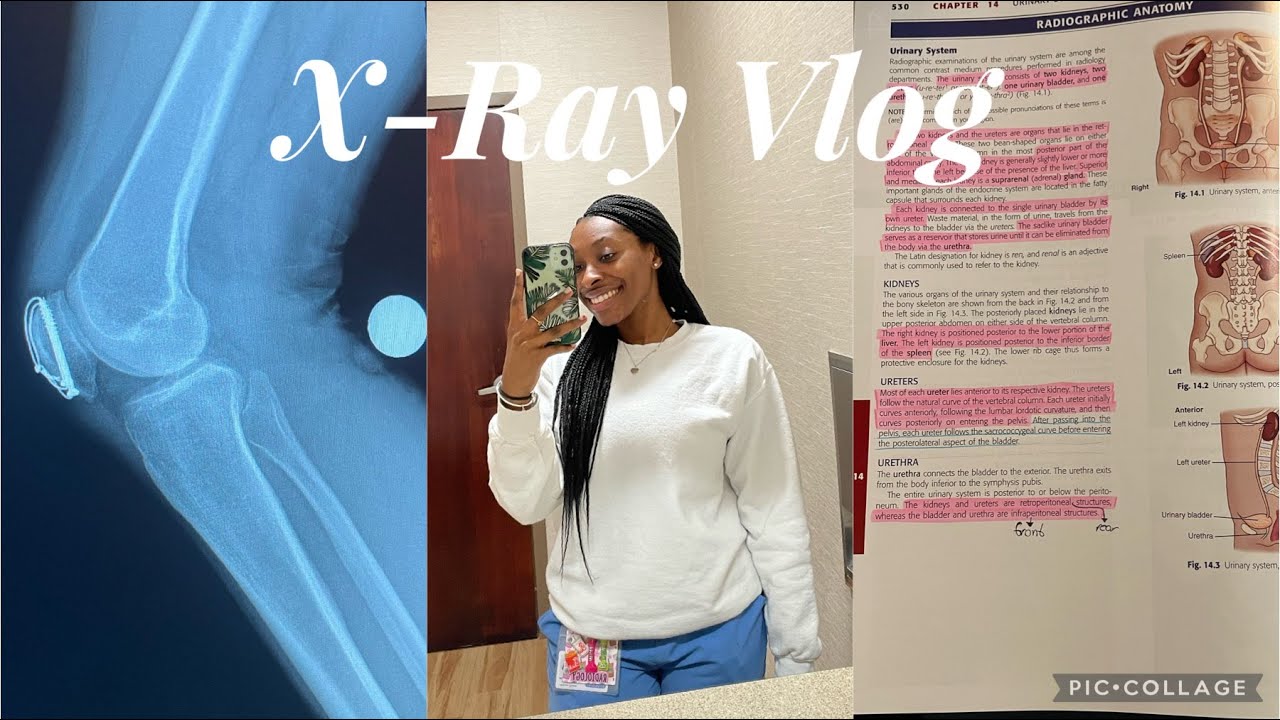 Day in the life of a Student X-Ray Tech | Vlog Series