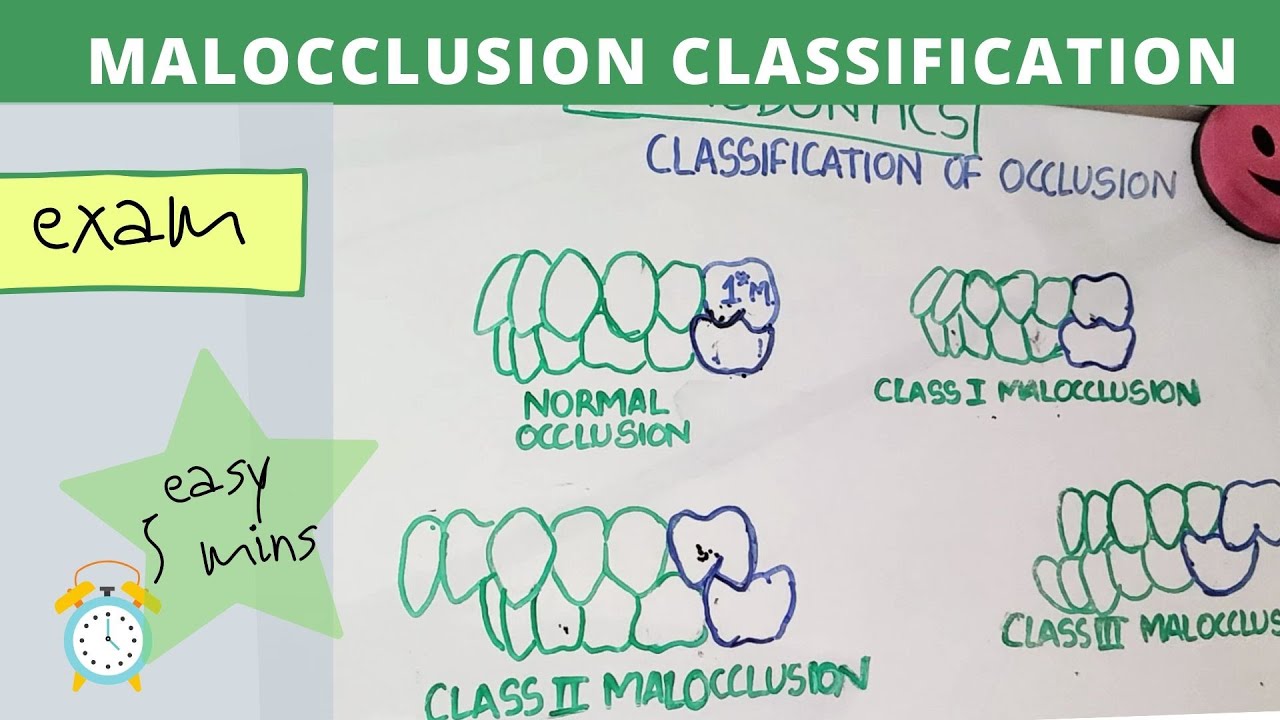 malocclusion of teeth I orthodontics lecture